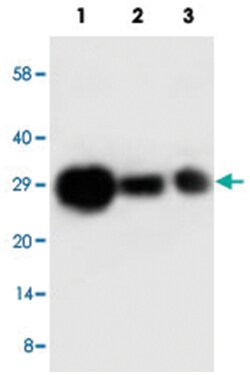 TIMP1 Rabbit anti-Human, Polyclonal Antibody, Abnova 100&mu;g; Unlabeled:Antibodies,