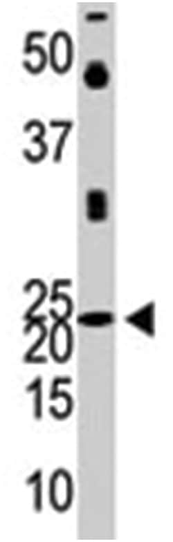 NEUROG1, Rabbit, Polyclonal Antibody, Abnova 400&mu;L; Unlabeled:Antibodies,