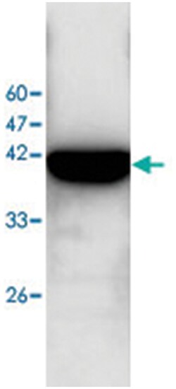 CKB Rabbit anti-Human, Polyclonal Antibody, Abnova 100&mu;L; Unlabeled:Antibodies,