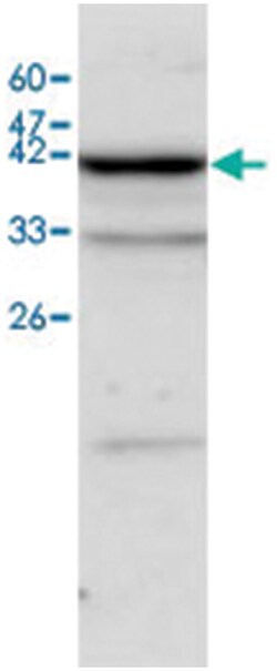 ALDH1B1 Rabbit anti-Human, Polyclonal Antibody, Abnova 100 &mu;L | Buy Online | Abnova | Fisher Scientific