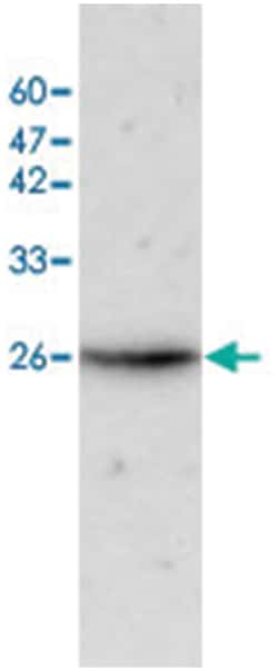NDUFV2, Rabbit, Polyclonal Antibody, Abnova 100&mu;L; Unlabeled:Antibodies,