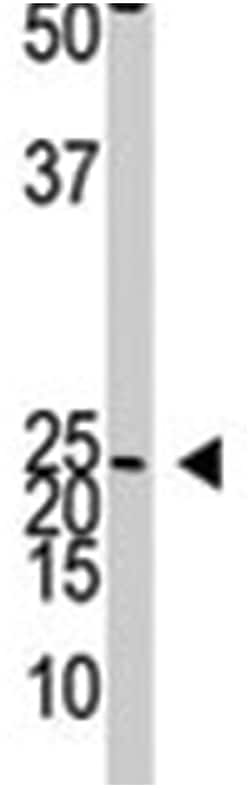 NEUROG2 Rabbit anti-Human, Mouse, Polyclonal Antibody, Abnova 400 &mu;L | Buy Online | Abnova Corporation | Fisher Scientific