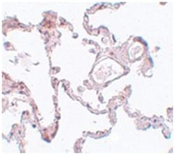 PLEKHM1, Rabbit, Polyclonal Antibody, Abnova 100 &mu;g | Buy Online | Abnova Corporation | Fisher Scientific