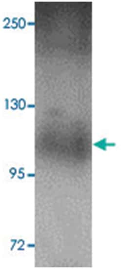 PLEKHM1, Rabbit, Polyclonal Antibody, Abnova 100 &mu;g | Buy Online | Abnova Corporation | Fisher Scientific