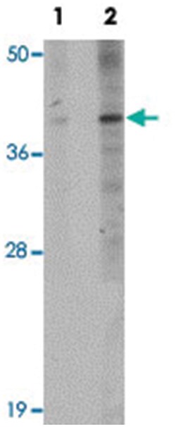 PPAPDC1B, Rabbit, Polyclonal Antibody, Abnova 100 &mu;g | Buy Online | Abnova | Fisher Scientific