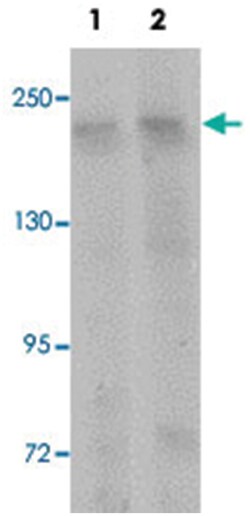 CCDC88A Rabbit anti-Human, Mouse, Rat, Polyclonal Antibody, Abnova 100&mu;g;