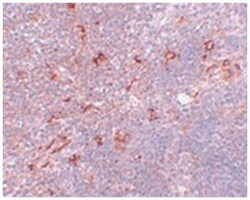 NAT11, Rabbit, Polyclonal Antibody, Abnova 100 &mu;g | Buy Online | Abnova | Fisher Scientific