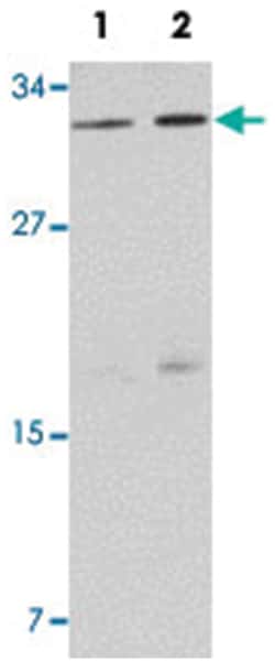 NAT11, Rabbit, Polyclonal Antibody, Abnova 100 &mu;g | Buy Online | Abnova | Fisher Scientific
