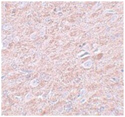 PRDM16, Rabbit, Polyclonal Antibody, Abnova 100 &mu;g | Buy Online | Abnova | Fisher Scientific