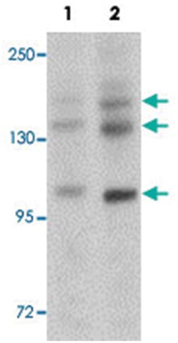 PRDM16, Rabbit, Polyclonal Antibody, Abnova 100 &mu;g | Buy Online | Abnova | Fisher Scientific