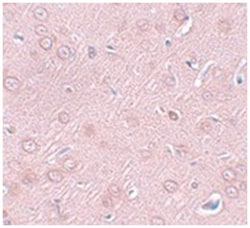 SYNGR2 Rabbit anti-Human, Rat, Polyclonal Antibody, Abnova 100 &mu;g | Buy Online | Abnova | Fisher Scientific