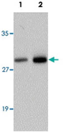 SYNGR2 Rabbit anti-Human, Rat, Polyclonal Antibody, Abnova 100 &mu;g | Buy Online | Abnova | Fisher Scientific
