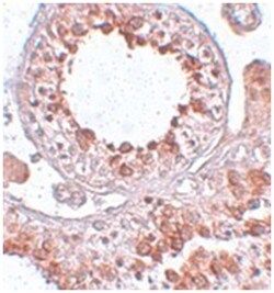 ESX1, Rabbit, Polyclonal Antibody, Abnova 100&mu;g; Unlabeled:Antibodies,