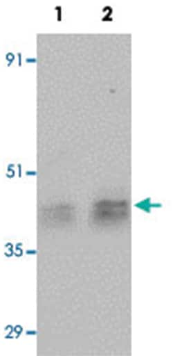 ESX1, Rabbit, Polyclonal Antibody, Abnova 100&mu;g; Unlabeled:Antibodies,