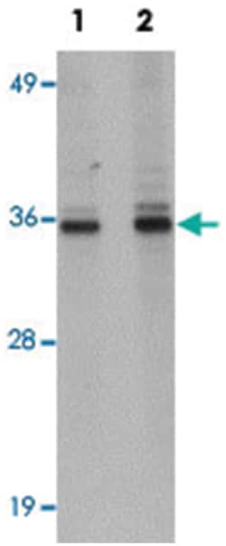 RSRC1, Rabbit, Polyclonal Antibody, Abnova 100&mu;g; Unlabeled:Antibodies,