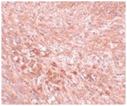 SEC16B, Rabbit, Polyclonal Antibody, Abnova™