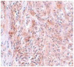 BCAS2, Rabbit, Polyclonal Antibody, Abnova 100 &mu;g | Buy Online | Abnova | Fisher Scientific