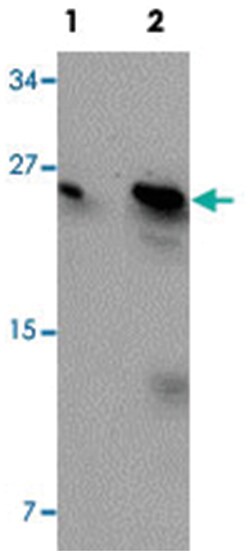 BCAS2, Rabbit, Polyclonal Antibody, Abnova 100 &mu;g | Buy Online | Abnova | Fisher Scientific