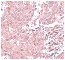 BCAS3 Rabbit anti-Human, Mouse, Rat, Polyclonal Antibody, Abnova 100&mu;g;