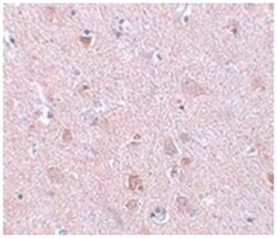 EFHD2, Rabbit, Polyclonal Antibody, Abnova 100&mu;g; Unlabeled:Antibodies,