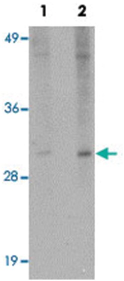 EFHD2, Rabbit, Polyclonal Antibody, Abnova 100&mu;g; Unlabeled:Antibodies,
