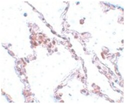 TMEM184B, Rabbit, Polyclonal Antibody, Abnova 100&mu;g; Unlabeled:Antibodies,