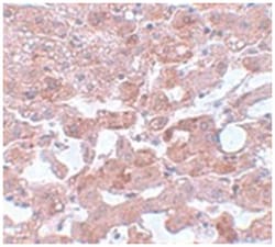 CDC16 Rabbit anti-Human, Mouse, Polyclonal Antibody, Abnova 100 &mu;g | Buy Online | Abnova Corporation | Fisher Scientific