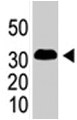 SNAI1 Rabbit anti-Human, Polyclonal Antibody, Abnova 400&mu;L; Unlabeled:Antibodies,