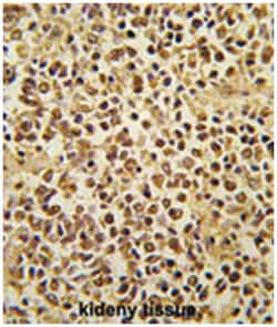 SNAI1 Rabbit anti-Human, Polyclonal Antibody, Abnova 400&mu;L; Unlabeled:Antibodies,