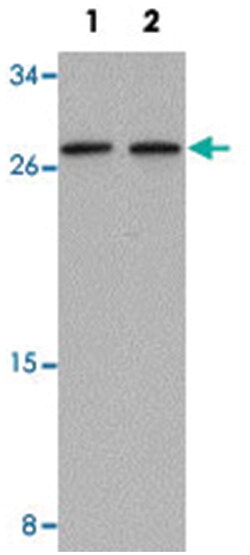 ANAPC11 Rabbit anti-Human, Mouse, Rat, Polyclonal Antibody, Abnova 100&mu;g;