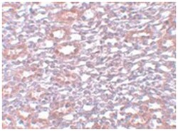 PIAS1 Rabbit anti-Human, Mouse, Rat, Polyclonal Antibody, Abnova 100 &mu;g | Buy Online | Abnova Corporation | Fisher Scientific