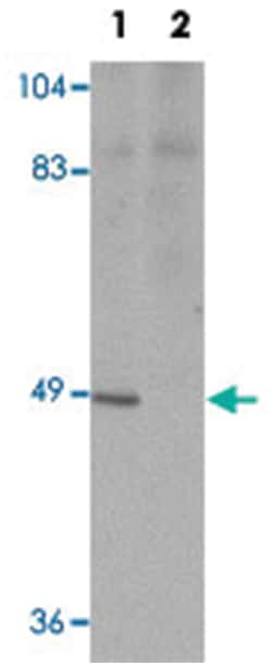 ATG13 Rabbit anti-Human, Mouse, Rat, Polyclonal Antibody, Abnova 100&mu;g;
