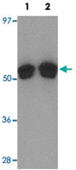 FOXO4 Rabbit anti-Human, Mouse, Rat, Polyclonal Antibody, Abnova 100&mu;g;