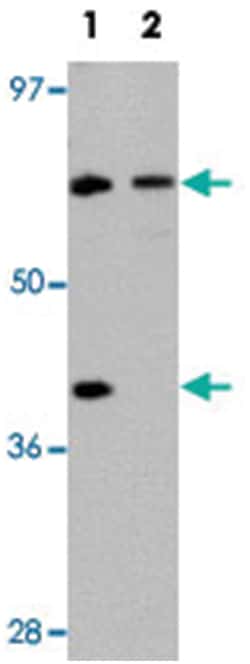 TCTN3, Rabbit, Polyclonal Antibody, Abnova 100&mu;g; Unlabeled:Antibodies,
