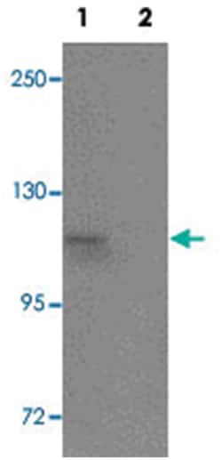 SCUBE1 Rabbit anti-Human, Polyclonal Antibody, Abnova 100&mu;g; Unlabeled:Antibodies,