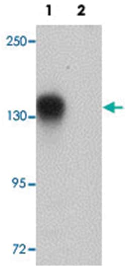 ATP11B, Rabbit, Polyclonal Antibody, Abnova 100&mu;g; Unlabeled:Antibodies,