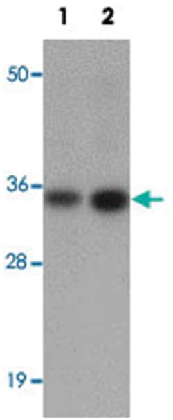 CALN1, Rabbit, Polyclonal Antibody, Abnova 100&mu;g; Unlabeled:Antibodies,