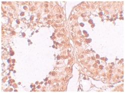 CRISP2, Rabbit, Polyclonal Antibody, Abnova 100&mu;g; Unlabeled:Antibodies,