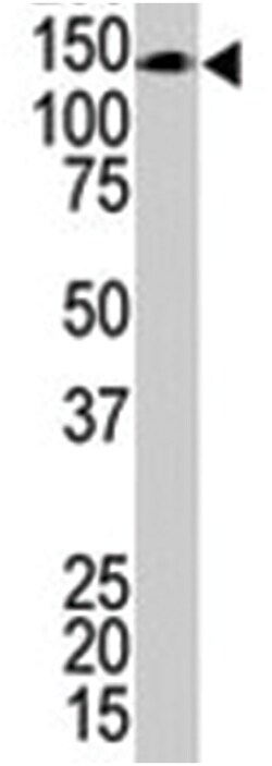 UBE4B, Rabbit, Polyclonal Antibody, Abnova 400&mu;L; Unlabeled:Antibodies,