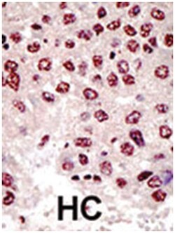 UBE4B, Rabbit, Polyclonal Antibody, Abnova 400&mu;L; Unlabeled:Antibodies,