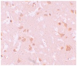 NLRP7, Rabbit, Polyclonal Antibody, Abnova 100&mu;g; Unlabeled:Antibodies,