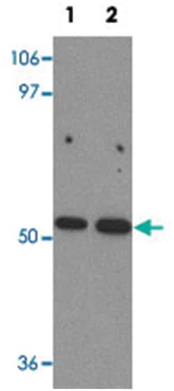 BANP, Rabbit, Polyclonal Antibody, Abnova 100 &mu;g | Buy Online | Abnova Corporation | Fisher Scientific
