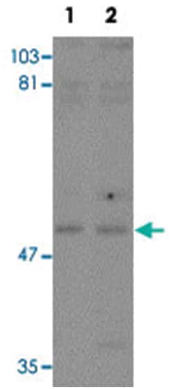 KPNA3, Rabbit, Polyclonal Antibody, Abnova 100 &mu;g | Buy Online | Abnova Corporation | Fisher Scientific