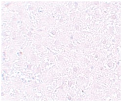 MEOX1, Rabbit, Polyclonal Antibody, Abnova 100&mu;g; Unlabeled:Antibodies,