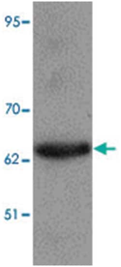 MEOX1, Rabbit, Polyclonal Antibody, Abnova 100&mu;g; Unlabeled:Antibodies,