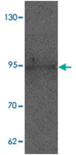 AXIN1, Rabbit, Polyclonal Antibody, Abnova 100&mu;g; Unlabeled:Antibodies,