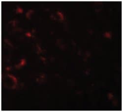 AXIN1, Rabbit, Polyclonal Antibody, Abnova 100&mu;g; Unlabeled:Antibodies,