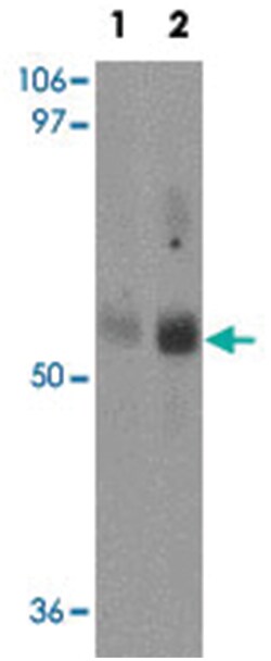 MFSD2, Rabbit, Polyclonal Antibody, Abnova 100&mu;g; Unlabeled:Antibodies,