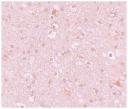 CXXC4 Rabbit anti-Human, Mouse, Rat, Polyclonal Antibody, Abnova 100&mu;g;