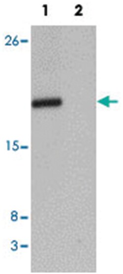CXXC4 Rabbit anti-Human, Mouse, Rat, Polyclonal Antibody, Abnova 100&mu;g;